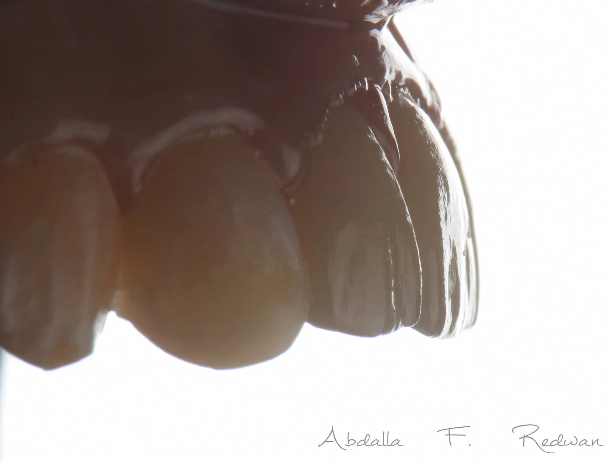 Enamel Luster Reflection